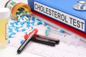 Cholesterol-Profile
