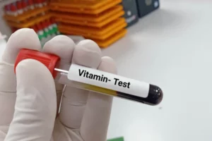vitamin-test