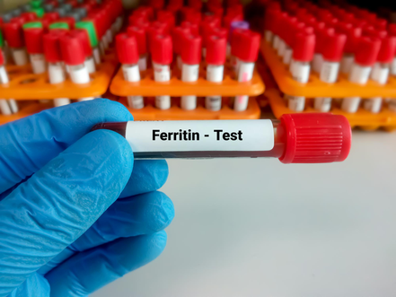 blood-sample-ferritin-test-with-laboratory-background-diagnosis-anemia